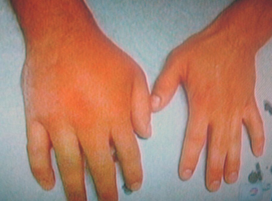 Zac Efron, Hands, Twit Pic Zac Efron, Hands, Twit Pic